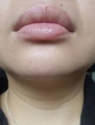 View Gallery Image #1