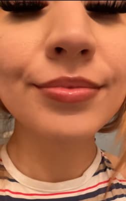 View Gallery Image #1