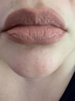 View Gallery Image #1