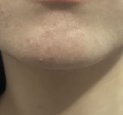 View Gallery Image #1