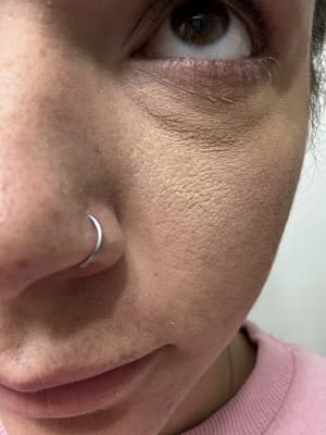 View Gallery Image #1