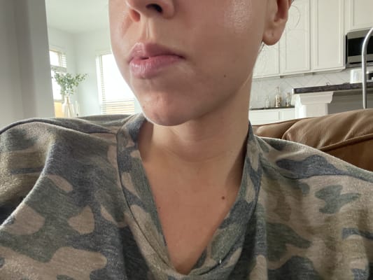 View Gallery Image #1