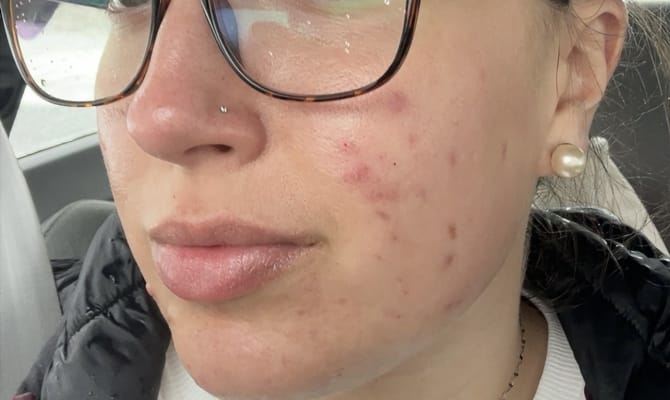 View Gallery Image #1