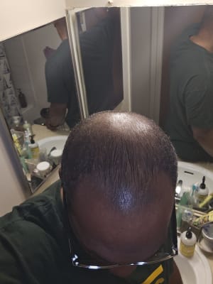 View Gallery Image #1