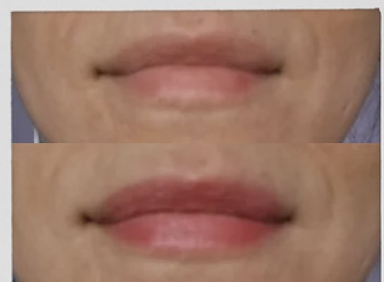 View Gallery Image #1