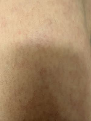 View Gallery Image #1