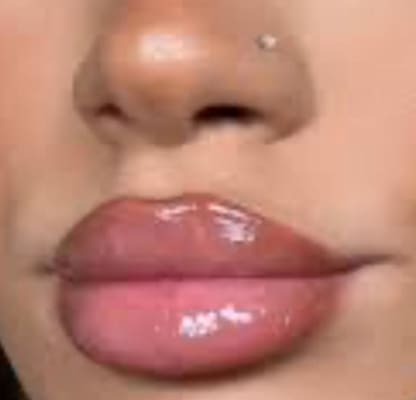 View Gallery Image #1