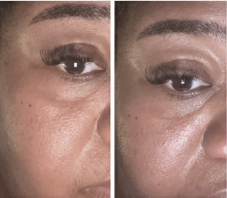 View Gallery Image #1