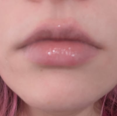 View Gallery Image #1