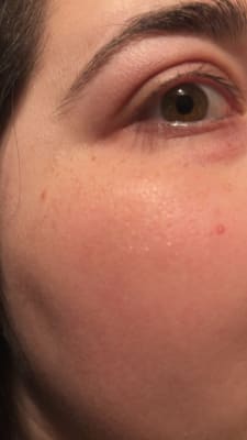 View Gallery Image #1