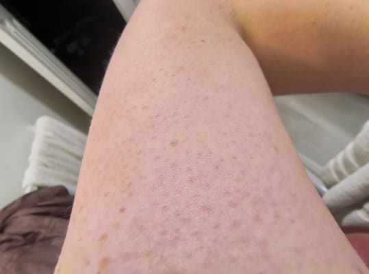 View Gallery Image #2