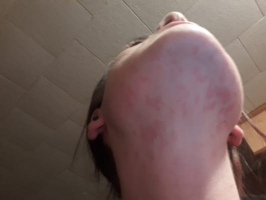 View Gallery Image #1