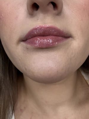 View Gallery Image #11