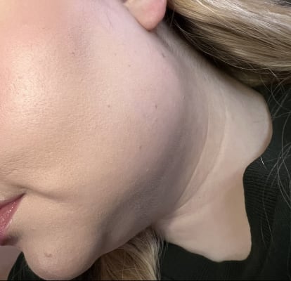 View Gallery Image #1