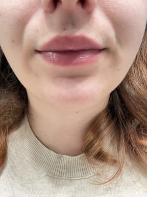 View Gallery Image #10