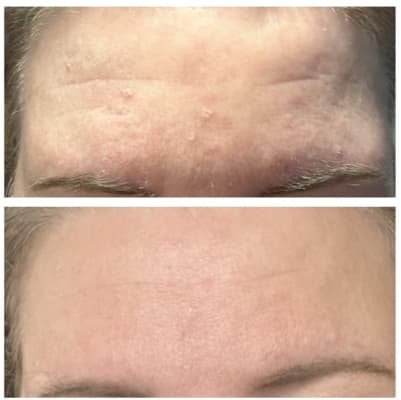 View Gallery Image #1