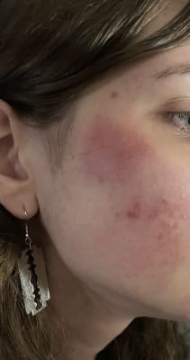 View Gallery Image #1