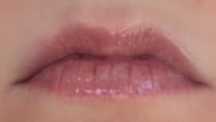 View Gallery Image #1