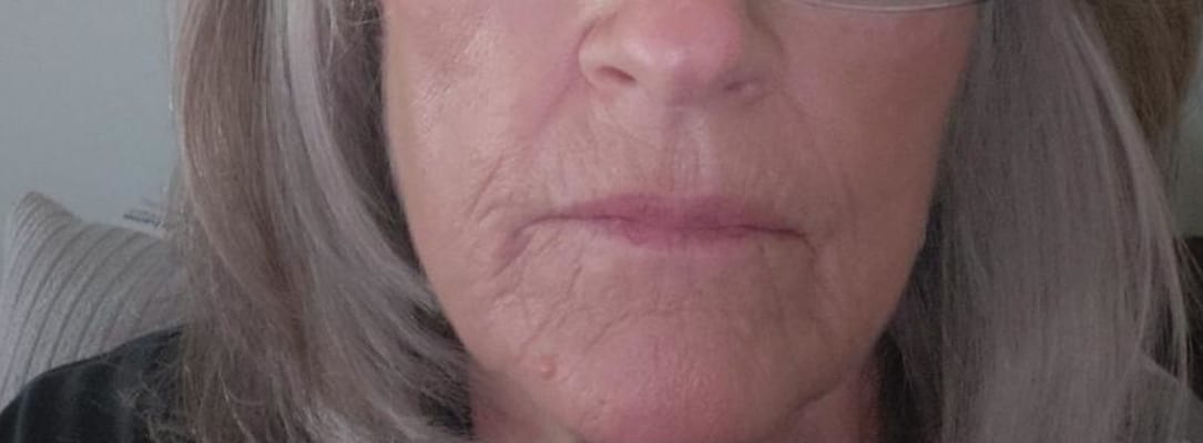 View Gallery Image #1