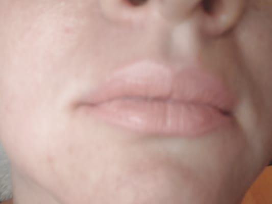 View Gallery Image #1