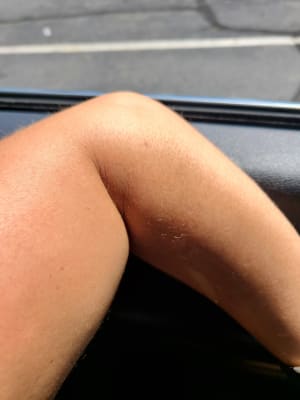View Gallery Image #1
