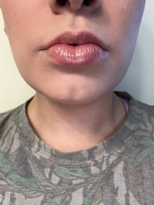 View Gallery Image #5