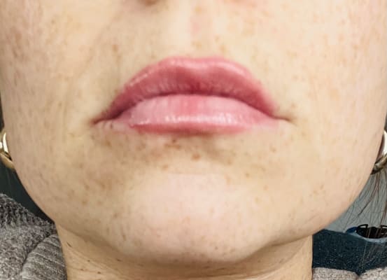 View Gallery Image #2