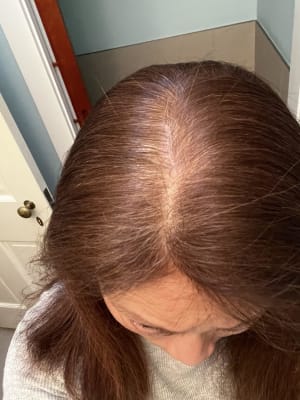 View Gallery Image #1