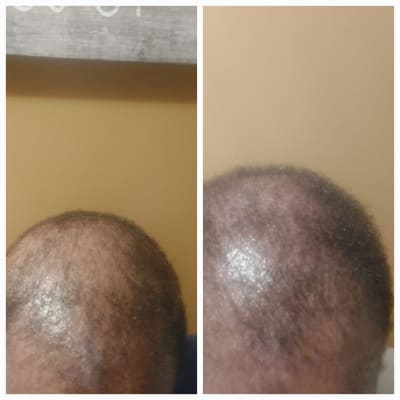 View Gallery Image #1