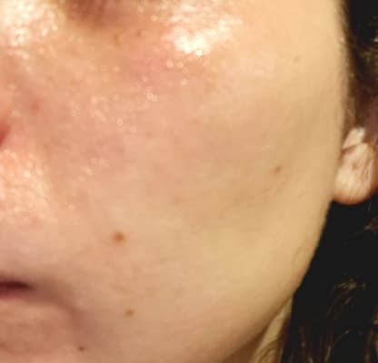 View Gallery Image #1