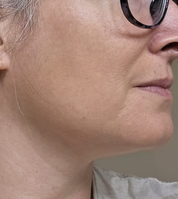 View Gallery Image #2