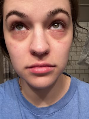 View Gallery Image #1