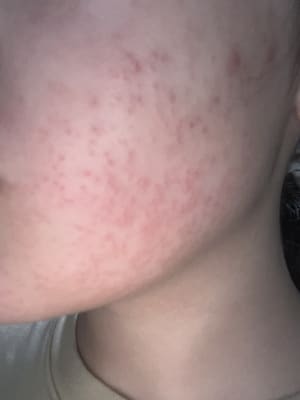 View Gallery Image #1