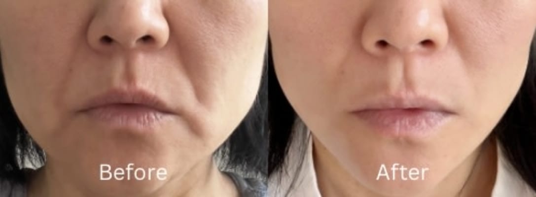 View Gallery Image #1