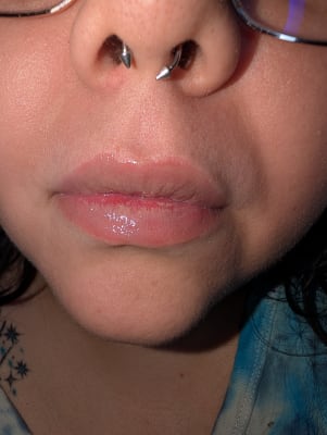 View Gallery Image #1