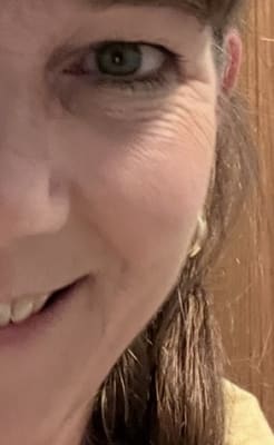 View Gallery Image #1