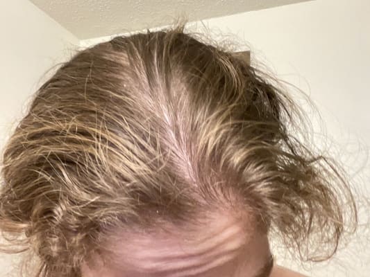 View Gallery Image #15