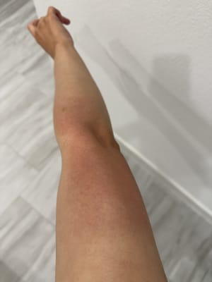 View Gallery Image #1