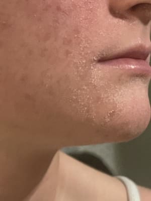 View Gallery Image #1