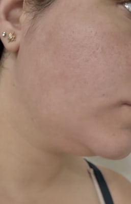 View Gallery Image #1