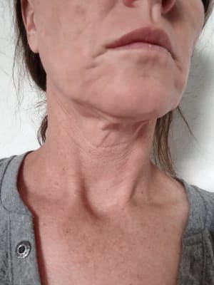 View Gallery Image #1