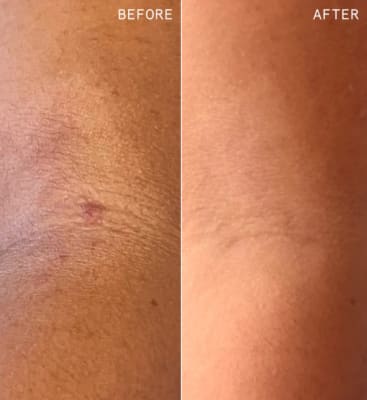 View Gallery Image #1