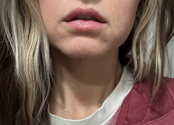 View Gallery Image #15