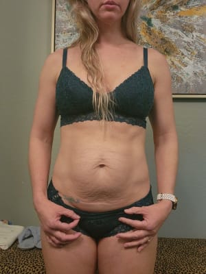 View Gallery Image #1