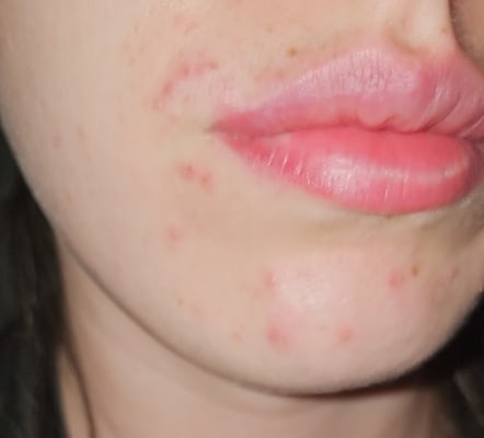 View Gallery Image #1
