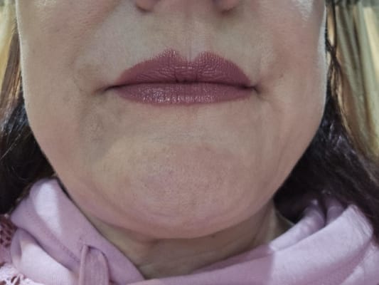 View Gallery Image #3