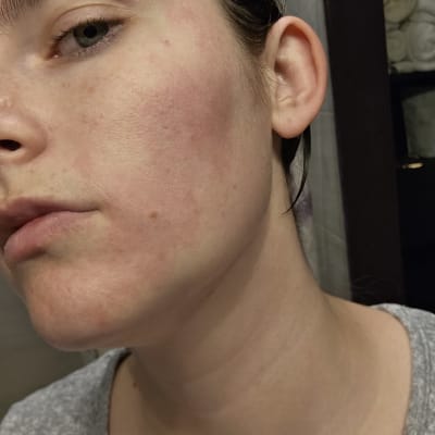 View Gallery Image #1