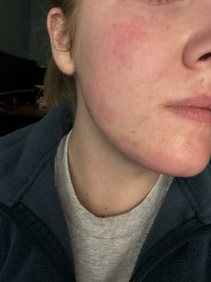 View Gallery Image #1