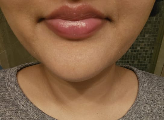 View Gallery Image #1