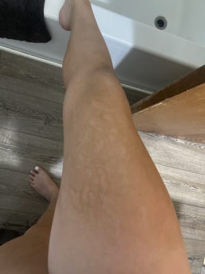 View Gallery Image #1